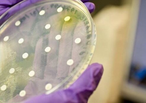 bakterijska kultura za diagnozo prostatitisa